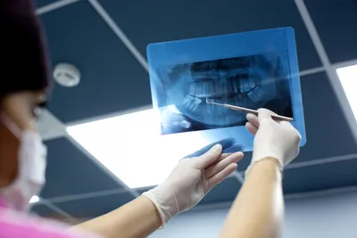 Radiografía Dental Digital vs Convencional: Guía Completa para Dentistas